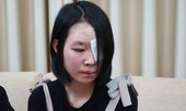 Tâm sự đau đớn của nữ sinh bị tạt axit giữa đường
