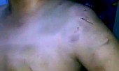 Bản tin 20H: Phẫn nộ bé trai 9 tuổi bị mẹ đánh đập bầm tím cơ thể