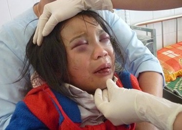 Bắt khẩn cấp đối tượng đánh đập con nuôi Bắt khẩn cấp đối tượng đánh đập con nuôi