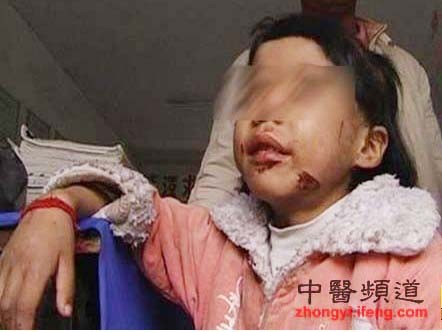 Phẫn nộ chuyện bố bôi phân lên miệng con gái Phẫn nộ chuyện bố bôi phân lên miệng con gái