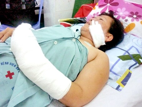 Cụ bà 73 tuổi vác dao chém tình địch vì ghen Cụ bà 73 tuổi vác dao chém tình địch vì ghen