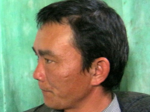 Một phụ nữ bị chồng bạo hành 10 năm Một phụ nữ bị chồng bạo hành 10 năm