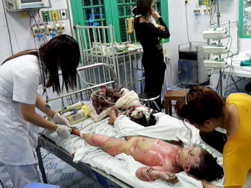 Thiêu sống cả nhà vì sinh con một bề Cháu Ngọc đang được cấp cứu