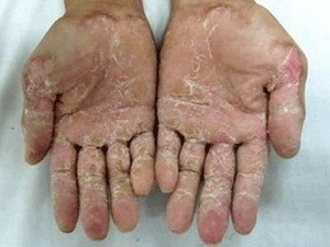 Nấm độc trong gạo là tác nhân gây bệnh lạ? Nấm độc trong gạo là tác nhân gây bệnh lạ?
