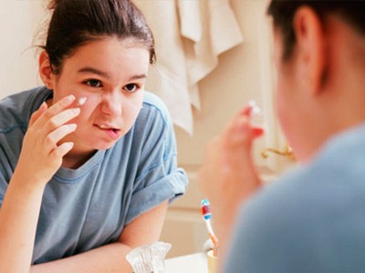 Trị mụn trứng cá bằng cỏ xạ hương Trị mụn trứng cá bằng cỏ xạ hương