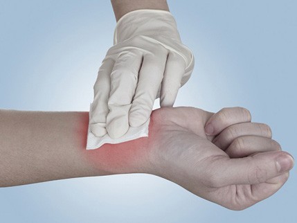 Sinh viên chế tạo chất cầm máu tức thì Sinh viên chế tạo chất cầm máu tức thì