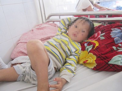 Cháu bé ba tuổi bị chó cắn gần đứt dương vật Cháu bé ba tuổi bị chó cắn gần đứt dương vật