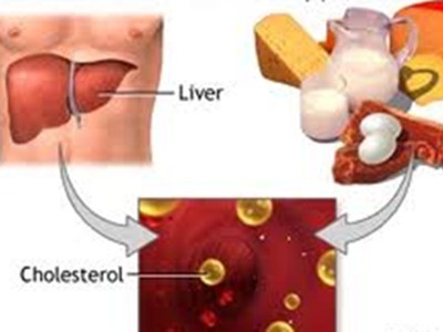 Làm gì để phòng ngừa tăng cholesterol máu? Làm gì để phòng ngừa tăng cholesterol máu?