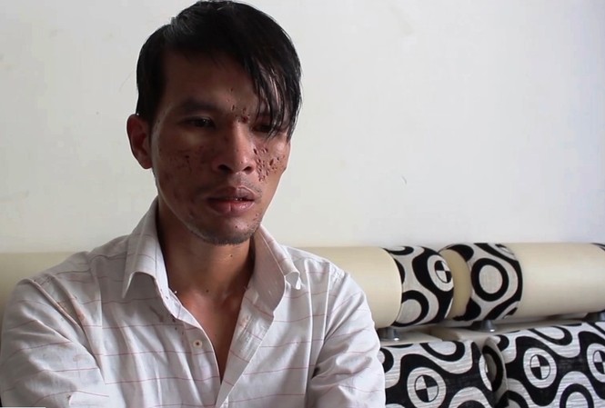 Vụ hành hạ cháu bé: Sẽ xử lý theo pháp luật Việt Nam Nghi phạm Nguyễn Thành Dũng.