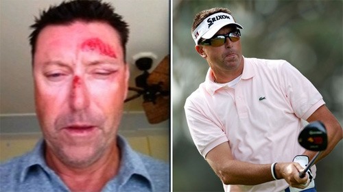 Golf thủ Australia bị bắt cóc, đánh đập và quẳng vào công viên Allenby. Ảnh: Reuters.