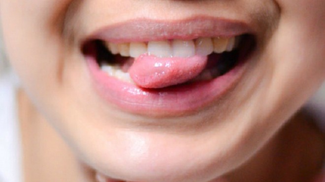 Giật mình tưởng bị nhiệt miệng hóa ra mắc ung thư lưỡi Ung thư lưỡi dễ bị bỏ qua vì nhầm với nhiệt miệng. Ảnh minh họa