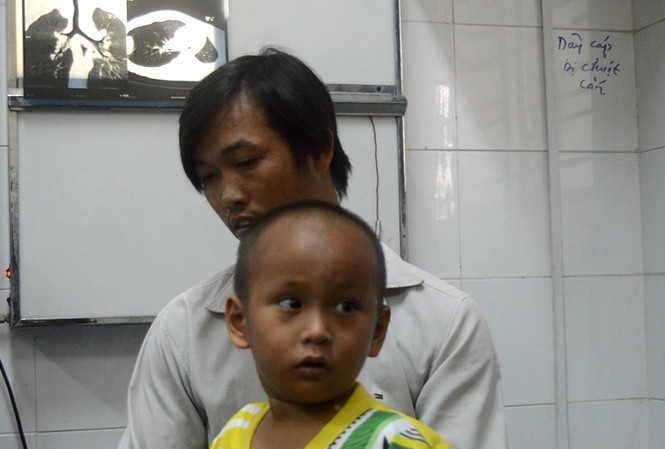 Bé trai 4 tuổi bị lõi kèn đồ chơi lọt vào phổi Bé B. bị lõi kèn đồ chơi lọt vào phổi.