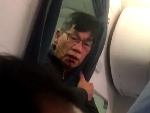Ông David Dao gãy mũi, mất hai răng cửa, cả nhà sốc nặng Bác sĩ David Dao bị thương sau khi bị lôi thô bạo khỏi máy bay của United Airlines hôm 9/4.