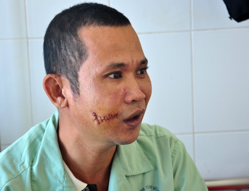 Đột nhập, đâm chủ nợ giữa đêm khuya Anh Vương đang điều trị tại Bệnh viện đa khoa Quảng Ngãi. Ảnh: Trí Tín