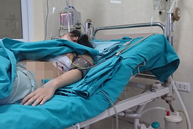 Một phụ nữ đang đi đường bị mảnh kim loại cắm sâu vào ngực Chị P.C. với tai họa từ trên trời rơi xuống
