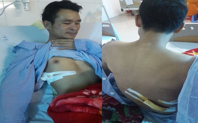 Bắt nghi phạm đâm nam thanh niên cứu cô gái gặp tai nạn Anh Sơn đang được điều trị tại bệnh viện