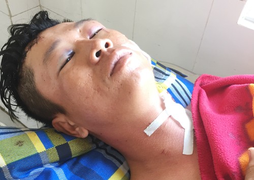 Công an bắt khẩn cấp kẻ vào viện truy sát bệnh nhân Anh Đợi bị chém nhiều nhát vào người do mời hàng xóm ra khỏi tiệc nhậu