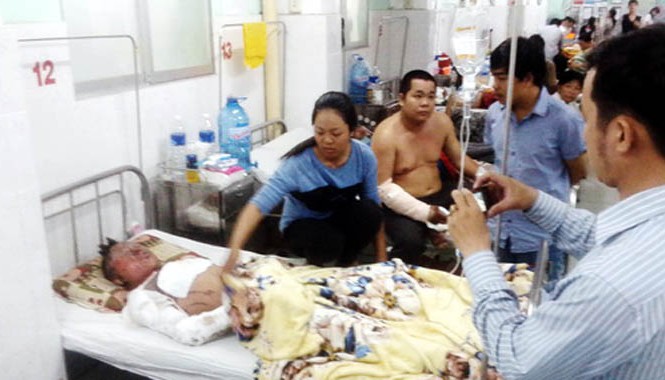 Bỏng nặng do hút thuốc lá gần bình xăng Anh Liêm đang điều trị tại bệnh viện đa khoa Đồng Nai. Ảnh: Hoàng Trường.