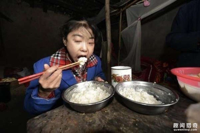 Kỳ lạ bé gái hai ngày ăn hết 5 kg gạo Cô bé không có cha mẹ, 10 năm trước, một người đàn ông độc thân tại ngôi làng nhỏ ven thành phố Trùng Khánh nhặt được bé đem về nuôi. Mỗi ngày bé ăn 8 bữa, cứ hai ngày lại ăn hết 5 kg gạo.