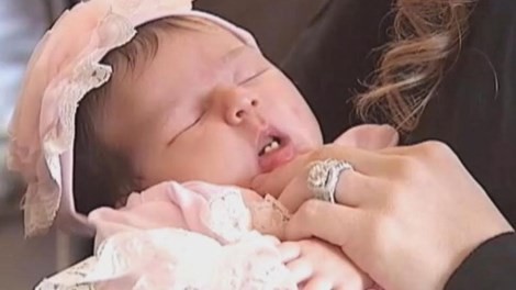 Cô bé mới sinh có 2 răng cửa Cô bé Alyssa mới chào đời và hai chiếc răng cửa