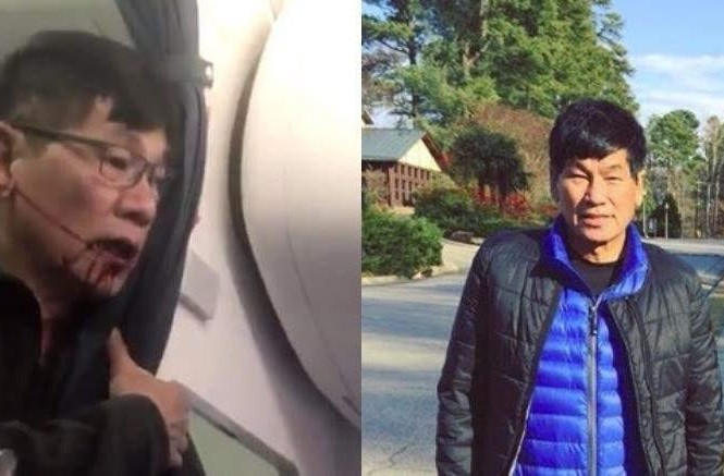 Bác sĩ bị kéo lê trên máy bay quyết định kiện United Airlines Bác sỹ Đào Duy Anh bị đánh chảy máu mồm và kéo lê xuống máy bay ( trái) và ngoài đời