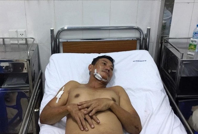 Côn đồ 'ngáo đá' đâm chạm phổi hàng xóm Nạn nhân Đặng Văn Lưu
