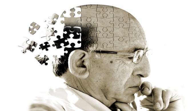 Ngủ nhiều làm tăng nguy cơ mắc bệnh Alzheimer Ngủ nhiều làm tăng nguy cơ mắc bệnh Alzheimer