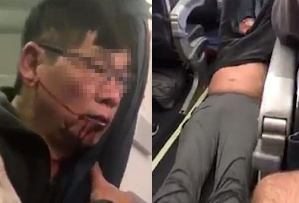 United Airlines lao đao sau lùm xùm kéo lê khách gốc Việt Vị bác sĩ gốc Việt bị kéo lê trên máy bay của hãng United Airlines.