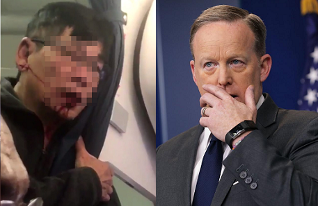 Nhà Trắng lên tiếng về scandal kéo lê khách của United Airlines Ông Sean Spicer cho rằng, nhân viên hãng United Airlines nên hành xử khéo léo hơn.