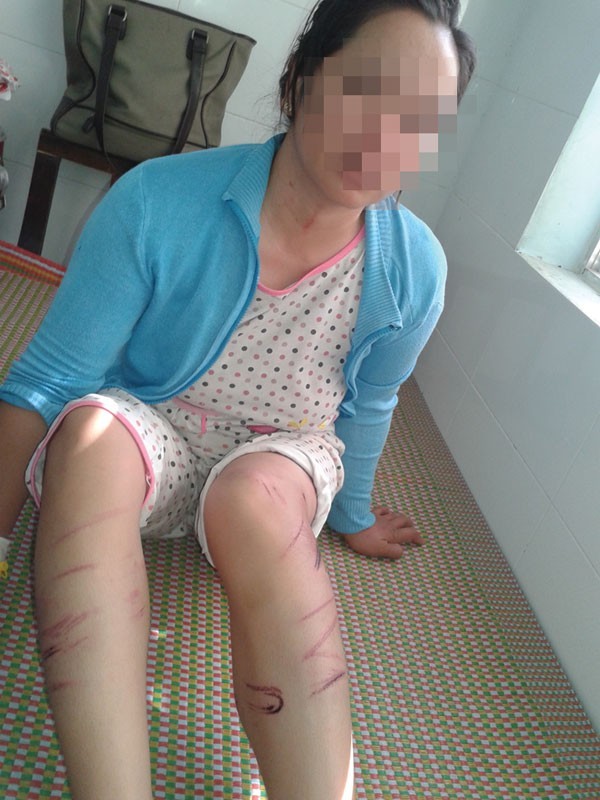 Tra tấn vợ dã man như thời trung cổ - ảnh 1