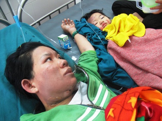 Bồng con nấu ăn, 2 mẹ con bị bỏng nặng - ảnh 1