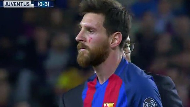 Messi ngã dập mặt trong ngày Barca rời Champions League - ảnh 1