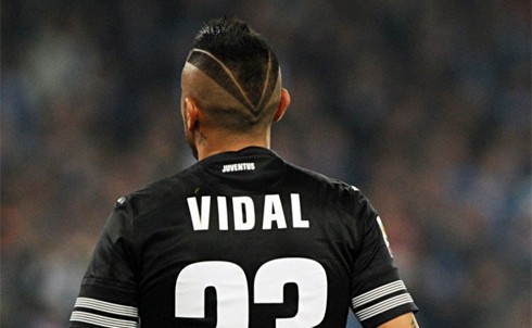 Đường cạo hình chữ V ấn tượng cảu Vidal