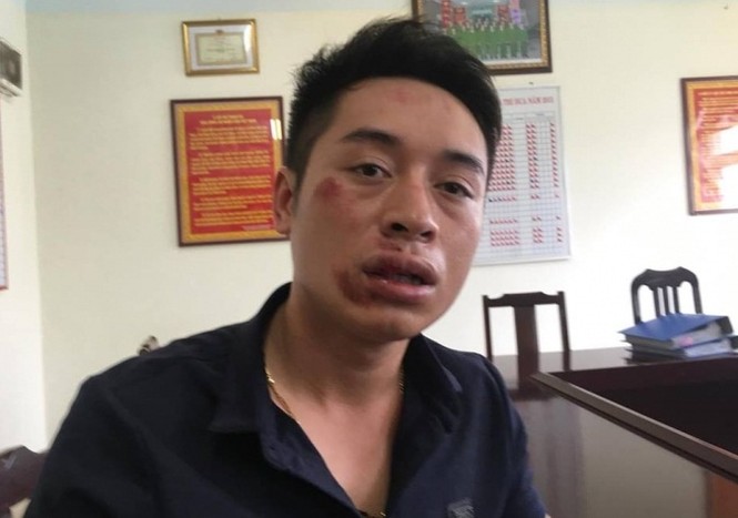 Vi phạm giao thông rồi đánh cảnh sát gãy răng? - ảnh 1