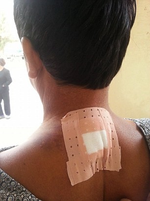 Tài xế xe ôm thoát chết kì diệu dù bị dao đâm xuyên cổ - ảnh 5