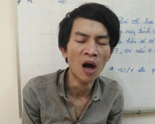 Bắt 'yêu râu xanh' cướp tài sản, giở trò với cụ bà - ảnh 1