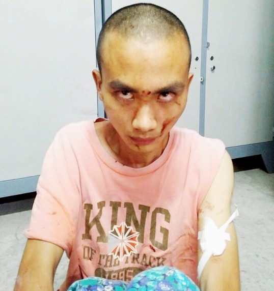 Án mạng trong chùa ở Sài Gòn: Lời kể của sư thầy bị truy sát - ảnh 2