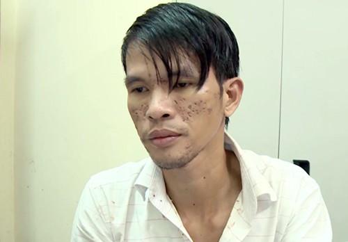 Bộ Công an muốn Campuchia giám định thương tật bé trai bị bạo hành - ảnh 1