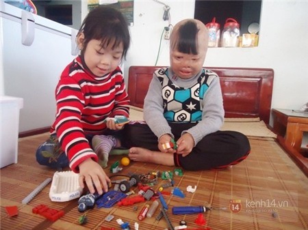 Hành trình 4 năm sống sót của cậu bé bị cha ruột đổ xăng đốt - ảnh 4