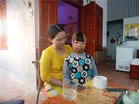 Hành trình 4 năm sống sót của cậu bé bị cha ruột đổ xăng đốt - ảnh 6