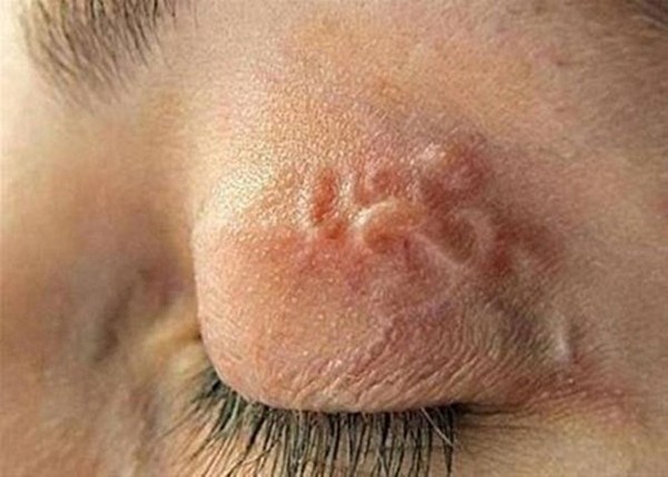 Kinh hoàng giun, sán ăn lục phủ ngũ tạng người - ảnh 3