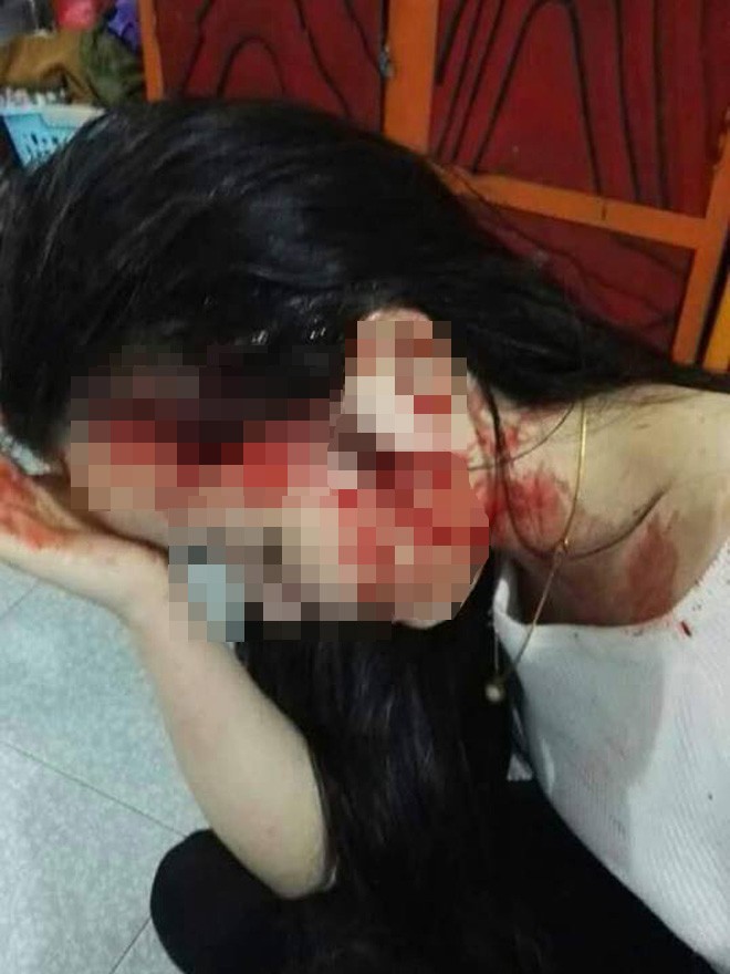 Đình chỉ cô giáo bắt nhốt