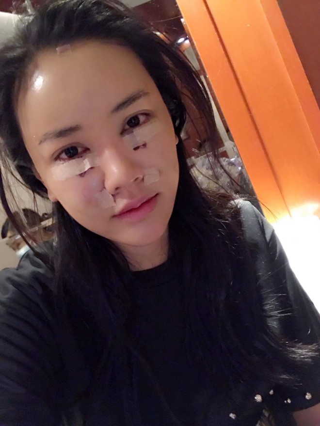 Maya chia sẻ gương mặt thẩm mỹ.