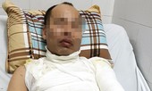Người đàn ông đi ô tô bị tạt axit giữa đường phố Hà Nội