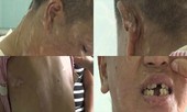 Bị đánh dã man trong 4 năm, 9X biến dạng khiến mẹ không nhận ra
