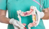 3 sai lầm khiến người viêm đại tràng không bao giờ thoát khỏi