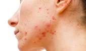 Những dấu hiệu 'lạ' của cơ thể có thể tiết lộ bệnh