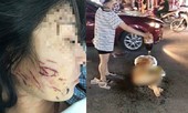 Ba phụ nữ bị khởi tố vì lột đồ đổ nước mắm vào người cô gái trẻ