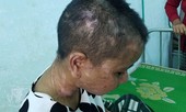 Hỏa tốc yêu cầu xử lý vụ cô gái bị tra tấn tàn bạo như thời trung cổ
