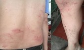 Tình tiết bất ngờ vụ người trả lời phỏng vấn VTV9 bị đánh dã man